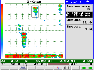 Б-Скан